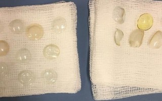 怎么把隐形眼镜拿掉，怎么把隐形眼镜拿掉视频