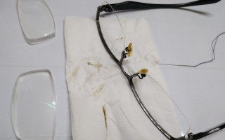 眼镜片发黄了用什么清洗，眼镜片发黄了用什么清洗最好