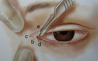 眼睛多少度是正常的，50岁眼睛多少度是正常的
